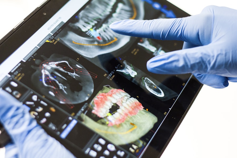 Digitale 3D-Aufnahme eines Kiefers auf einem Tablet